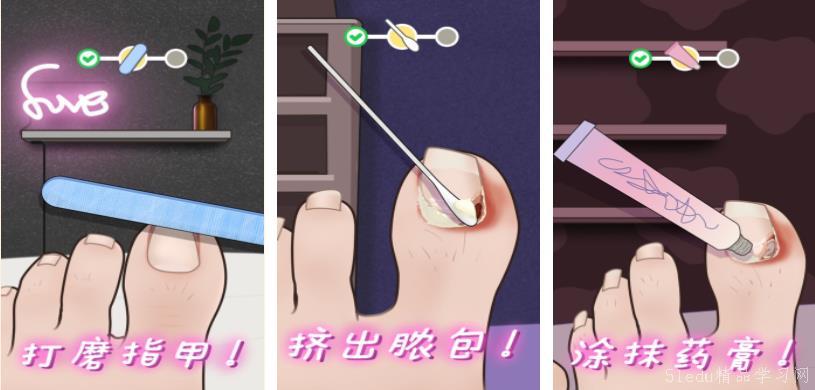 革新足部护理体验,新款修脚工具亮相!